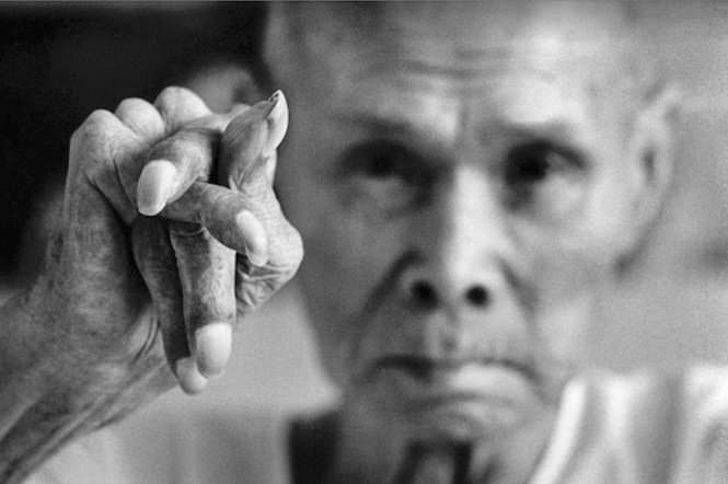 Bàn tay co quắp của một ngư dân bị nhiễm độc thủy ngân ở Minamata năm 1970 - Ảnh: SHISEI KUWABARA