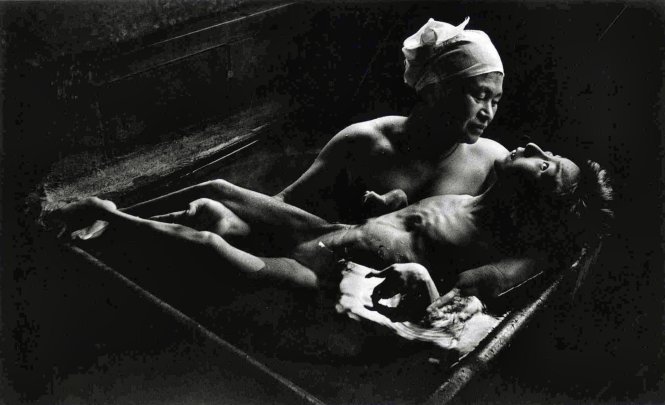 Bà mẹ Ryoko Uemura tắm cho con gái Tomoko bị nhiễm bệnh Minamata - Ảnh: EUGENE SMITH