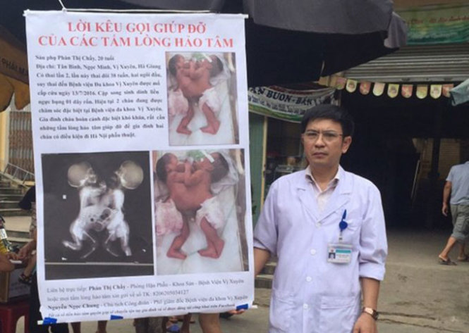 Bác sĩ Nguyễn Ngọc Chung, phó giám đốc Bệnh viện Vị Xuyên (Hà Giang), đã ra giữa chợ vận động hỗ trợ phẫu thuật cho hai bé song sinh dính liền nhau - Ảnh: NGUYỄN THỊ MAI