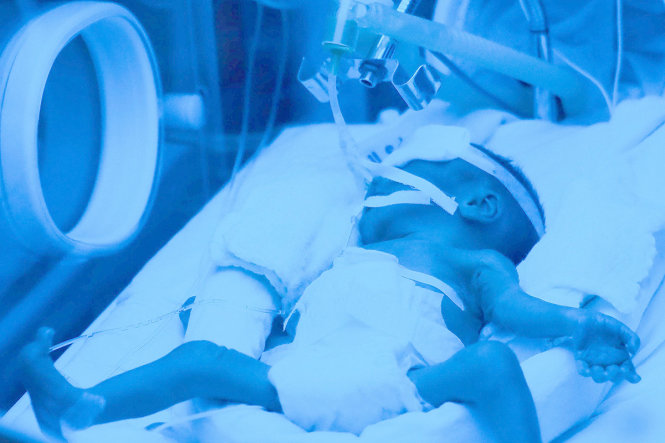 Bé Gấu con của chị Đậu Thị Huyền Trâm hiện đang được chăm sóc trong lồng ấp tại Bệnh viện Phụ sản T.Ư - Ảnh: NGUYỄN KHÁNH