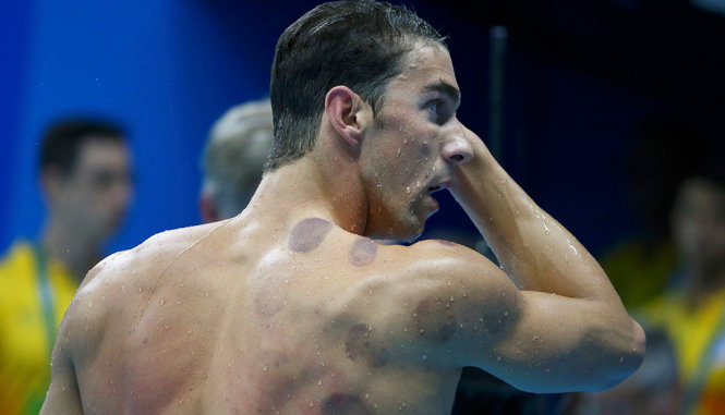 Kình ngư Michael Phelps với nhiều dấu giác hơi khi thi đấu tại Olympic Rio 2016 - Ảnh: REUTERS