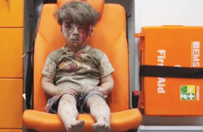 Ảnh chụp lại từ video đăng trên phương tiện truyền thông xã hội cho thấy cảnh một cậu bé với khuôn mặt đầy máu ngồi trong xe cứu thương - Ảnh: Reuters