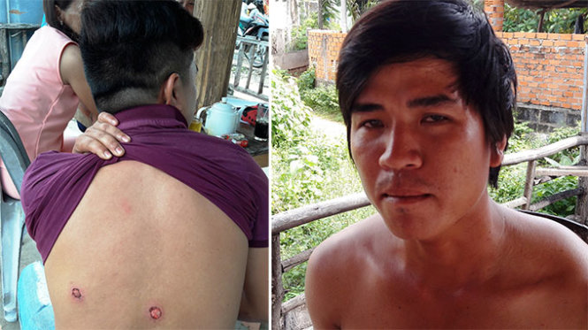 Hai nạn nhân Lê Văn Thảo (trái) và Trần Vinh Tuấn - Ảnh: NGUYỄN NAM
