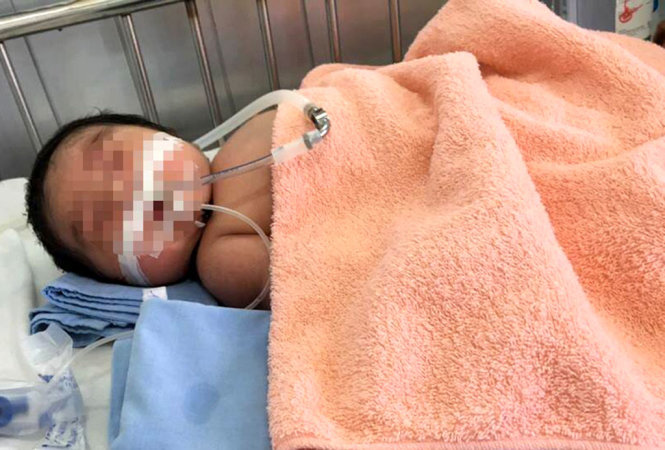 Cháu bé sơ sinh con của chị Gấm nằm điều trị tại Bệnh viện - 
Ảnh: GĐCC