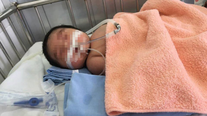 Cháu bé sơ sinh con của chị Gấm nằm điều trị tại Bệnh viện - Ảnh gia đình cung cấp
