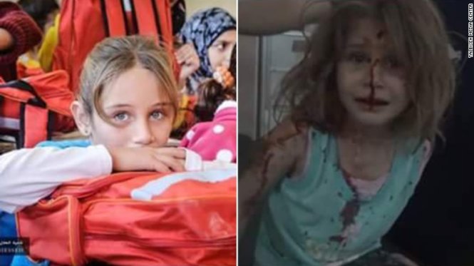 Hãy xem ảnh về bé gái Syria dễ thương này! Bằng sự cố gắng và nỗ lực không ngừng, cô bé đã vượt qua khó khăn để sống sót và cười đùa. Qúa trình hồi phục của cô bé là một lòng tin đầy cảm hứng về tình người.