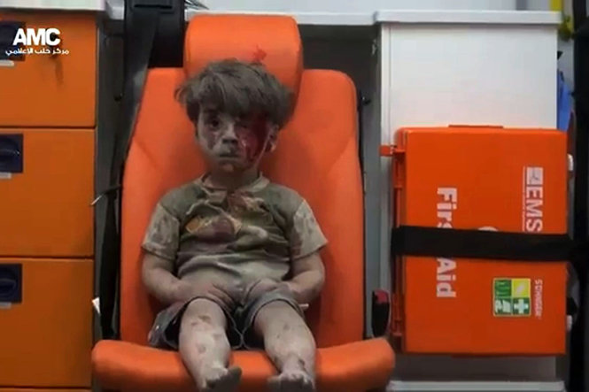 Em bé 5 tuổi Omran Daqneesh được cứu sống khỏi một vụ không kích nhưng trên thân thể em đầy bụi và vết máu. Hình ảnh đau thương của em bé Syria này đã lập tức khiến dư luận toàn thế giới bàng hoàng về thực trạng khốc liệt tại Syria - Ảnh: Mahmoud Raslan/Aleppo Media Center