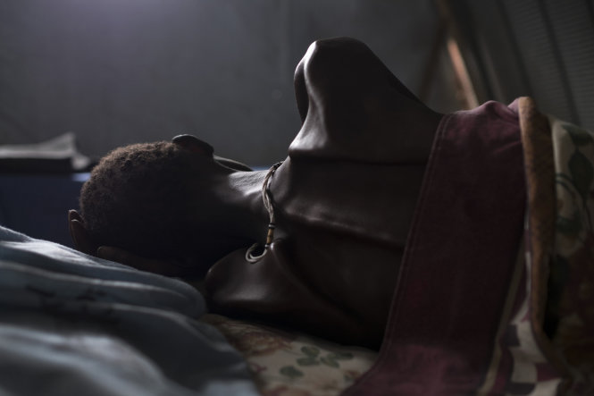Một người đàn ông gầy giơ xương vì đói ăn tại một khu trại tị nạn. Kể từ cuối 2013, Nam Sudan trải qua một cuộc nội chiến với rất nhiều cuộc cưỡng hiếp tập thể, thảm sát dân thường và không kể hết số người phải bỏ xứ ra đi - Ảnh: New York Times