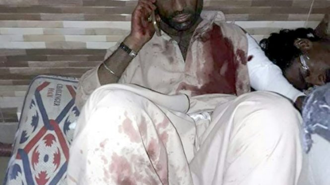 Một nạn nhân của vụ đánh bom đền thờ Hồi giáo Sufi nói chuyện điện thoại ở bệnh viện - Ảnh: AFP
