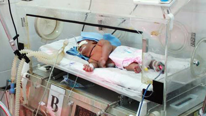 Cháu bé con chị H'Ngọc ở huyện Krông Bông, Đắk Lắk nhiễm trùng uốn ván được điều trị tích cực tại Bệnh viện Đa khoa Đắk Lắk - Ảnh: B.D.