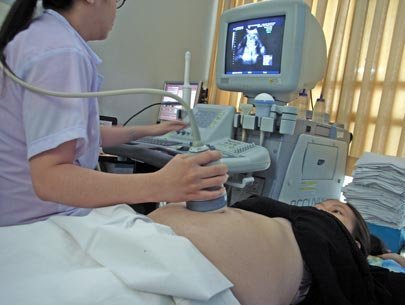 Siêu âm thai là công nghệ tiên tiến giúp cho các bà mẹ theo dõi sự phát triển của thai nhi. Hãy xem hình ảnh siêu âm để chứng kiến sự trưởng thành của em bé trong bụng mẹ.