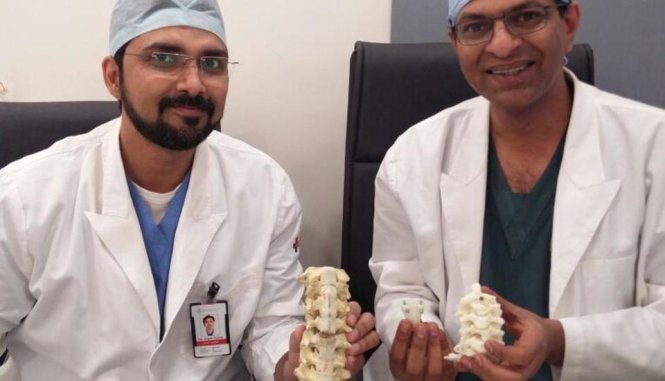 (Từ trái sang) các bác sĩ Gopal Kumar và V Anand Naik trong nhóm phẫu thuật ghép đốt sống cổ in bằng công nghệ 3D giúp một phụ nữ có thể đi lại bình thường tại Ấn Độ - Ảnh: Hindustantimes