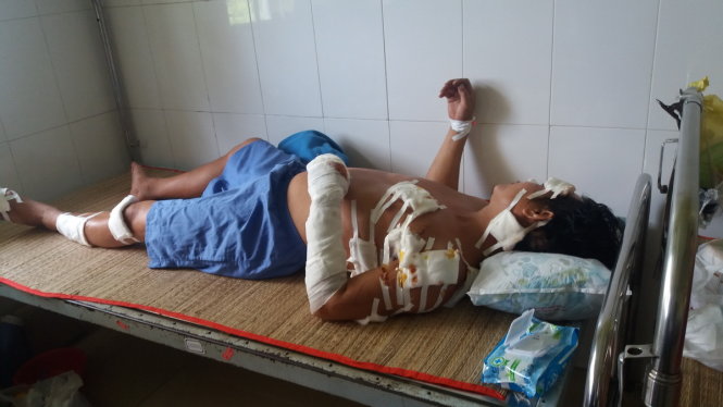 Anh Giang đang được điều trị tại bệnh viện - Ảnh: Trúc Ngọc