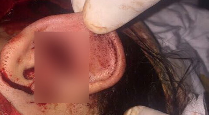 Các vết thương trên trán, mắt, tay, tai của Trúc do bị nhóm đối tượng dùng hung khí tấn công đêm 30-3 - Ảnh: FB hiệp sĩ Nguyễn Việt Sin