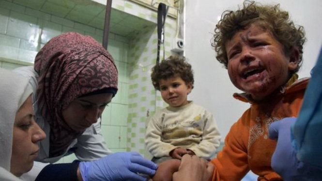 Trẻ em bị thương trong vụ đánh bom đang được điều trị tại bệnh viện - Ảnh: AFP