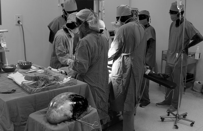 Các bác sỹ trong ca phẫu thuật cho bệnh nhân Y - Ảnh: BVCC