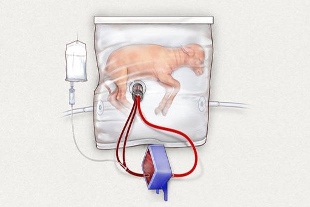 Phác họa túi nước ối tựa tử cung giúp cừu sinh non phát triển bên ngoài cơ thể mẹ - Ảnh: Children's Hospital of Philadelphia