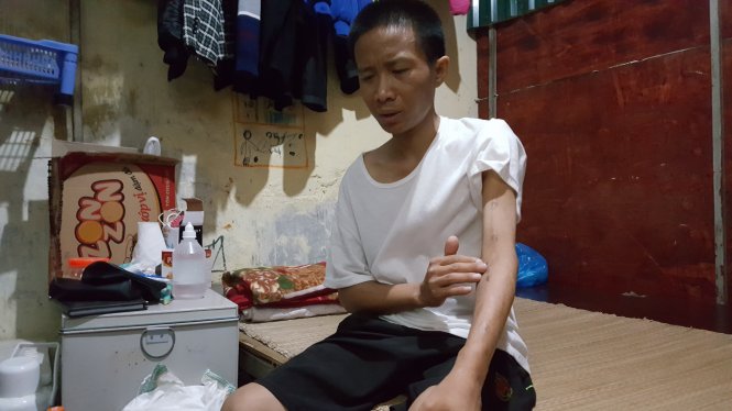 Anh Phạm Duy Tha (33 tuổi, Hà Nam), chạy thận ở Bệnh viện Bạch Mai, sống trong căn gác bé xíu ở “xóm chạy thận” mà vợ chồng anh gắn bó mấy năm nay - Ảnh: Q.LIÊN