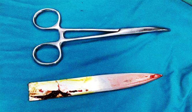 Lưỡi dao được rút ra từ lưng nạn nhân