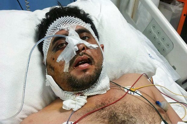 Ahmed Abdul Qadir nằm viện sau khi bị bắn tại Thổ Nhĩ Kỳ - Ảnh: Middle East Eye