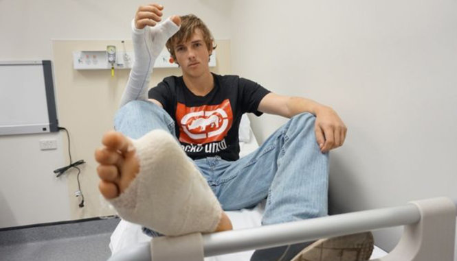 Zac Mitchell vừa được các bác sĩ cắt ngón chân cái thay thế ngón tay cái - Ảnh: BBC News