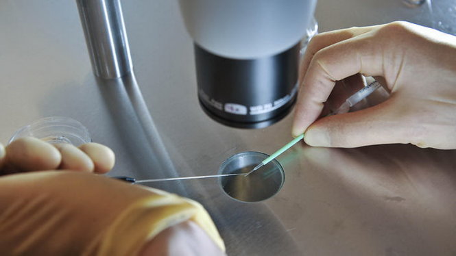 Các nhà nghiên cứu đang nỗ lực ngăn ngừa bệnh tật cho con người từ giai đoạn bào thai - Ảnh: AFP