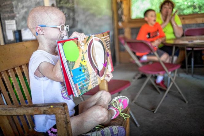 Em Meghan Waldron bị chứng già sớm tham gia chương trình đọc sách cho trẻ em ở trại Kee-wanee tại Mỹ hôm 1-8 - Ảnh: TWITTER