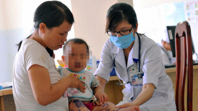 Một bệnh nhi bị tay chân miệng nặng đang được điều trị tại Bệnh viện Nhi Đồng Đồng Nai - Ảnh: A LỘC