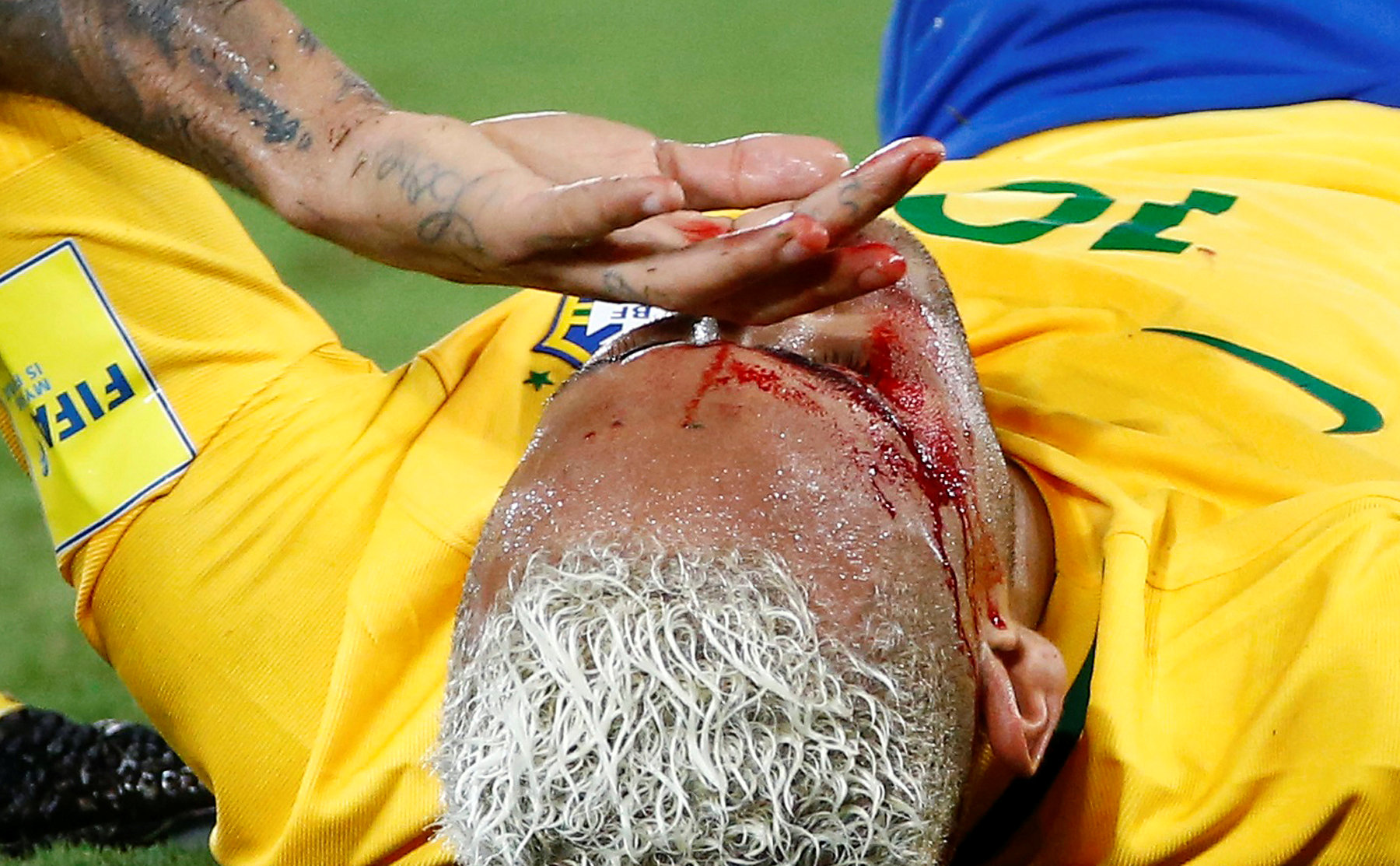 Neymar đổ máu sau khi bị đối phương chơi xấu. Ảnh: REUTERS
